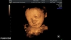 Amazing ultrasound scan http://www.scan4d.co.uk/ call 08000075076