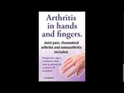 Download Arthritis in Hands and Arthritis in Fingers  Rheumatoid Arthritis and Osteoarthritis Includ