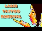 Laser Tattoo Removal Glen Allen VA Tattoo Removal