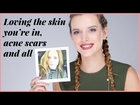 Bella Thorne on Loving Her Skin — Including Her Acne Scars | Pretty Unfiltered